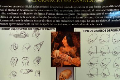 F2016___08883 Samaipata, musée archéologique: procédés de déformation volontaire du crâne chez les enfants des classes dominantes (procédé également utilisé dans de...
